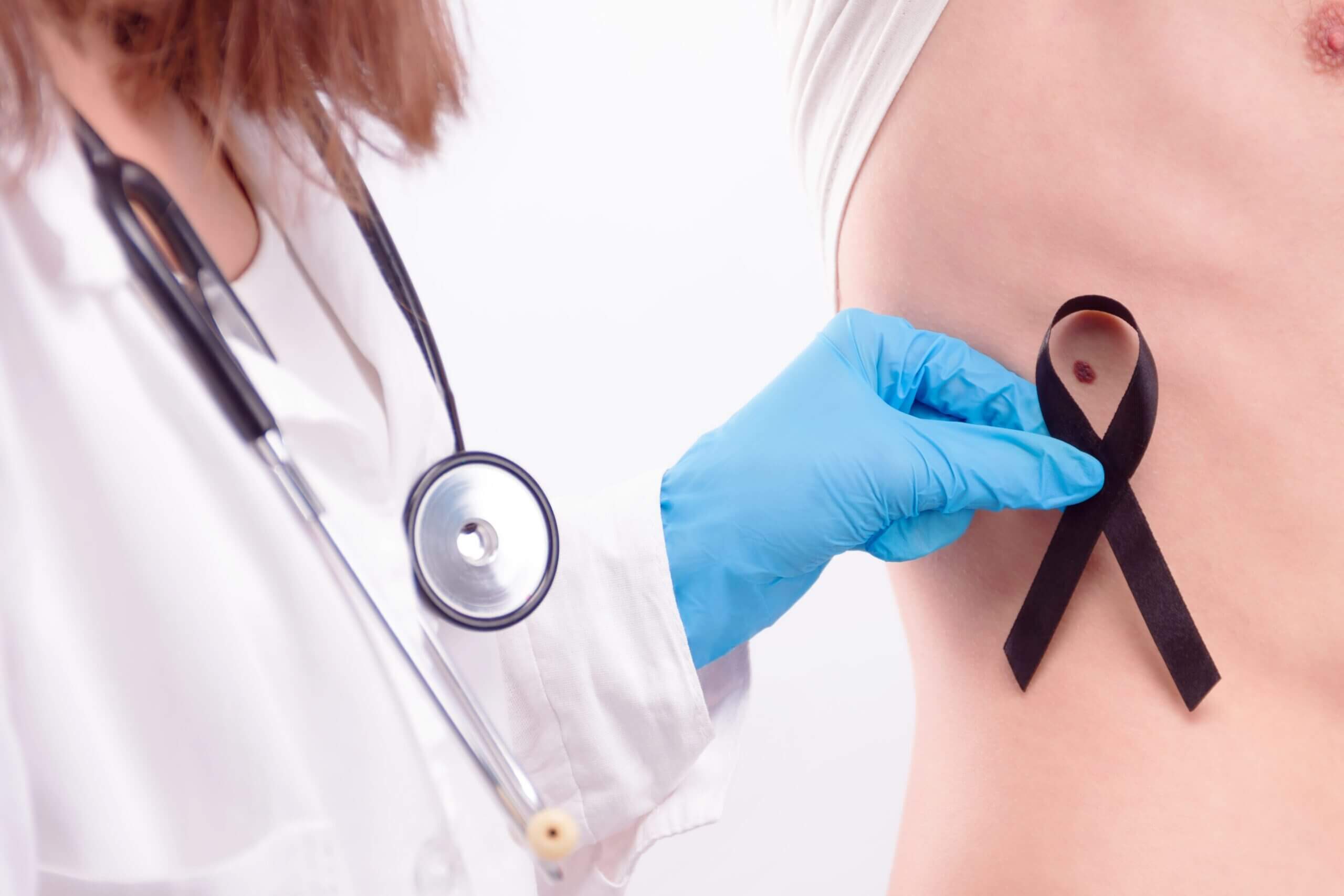 A Parkwood Skin Clinic doctor doing a skin cancer check on the patient