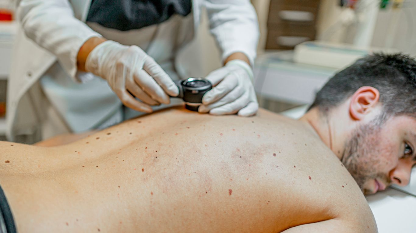 patient getting a skin check