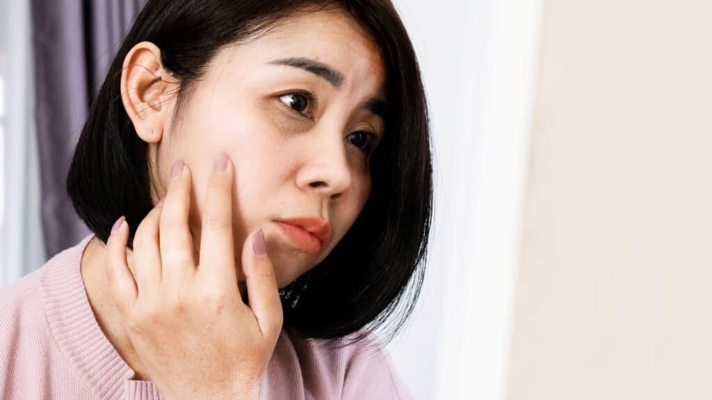 asian woman with dark circle under her eyes