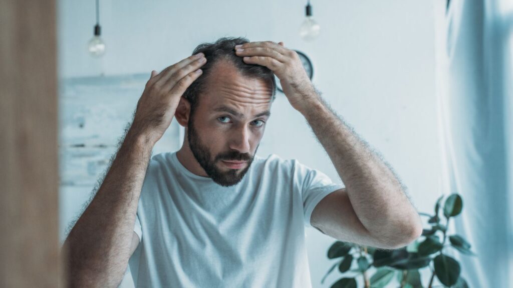 man worried of his hair loss