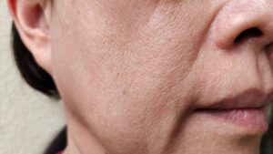 fine lines on a mature woman face