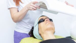 Acne Vulgaris Phototherapy